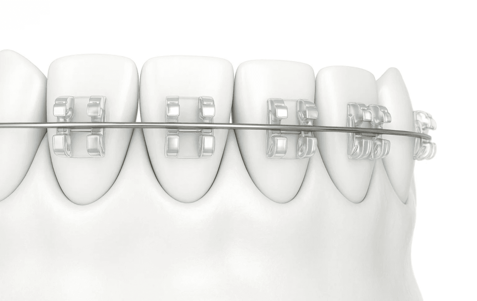 Orthodontie moderne
